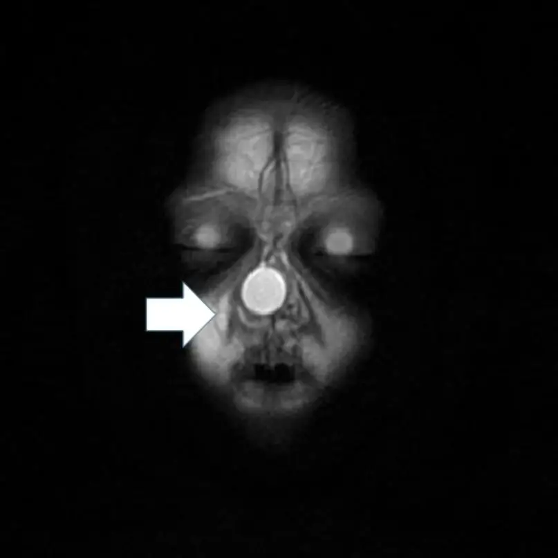 image-20250630093652-2
